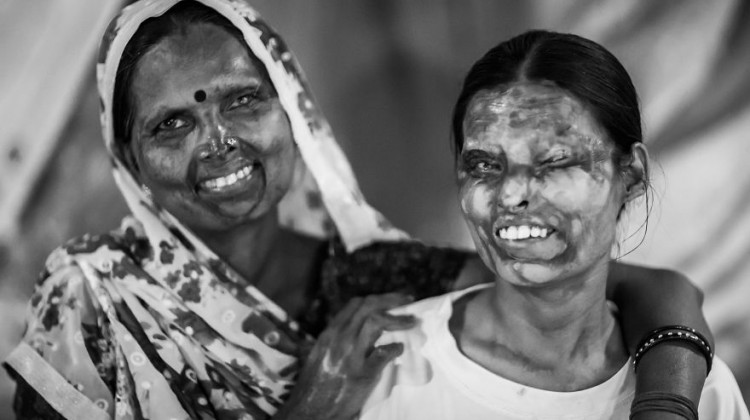 portraits-of-acid-attacks-survivors-in-india-sheroes-hangout
